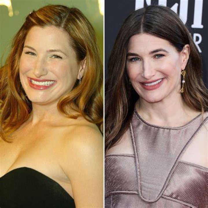 Kathryn Hahn Plastic Surgery