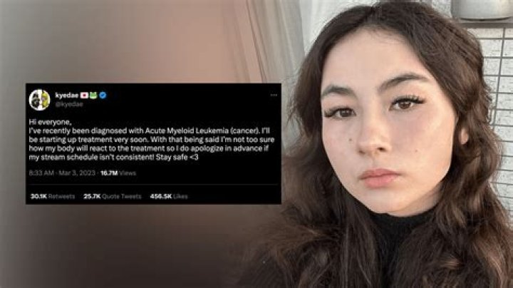 Valorant favorite streamer Kyedae updates her fans regarding the news of her recovery
