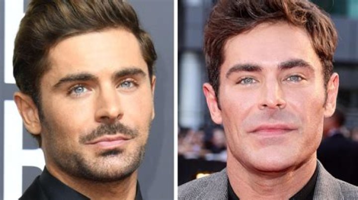 Zac Efron Face Accident